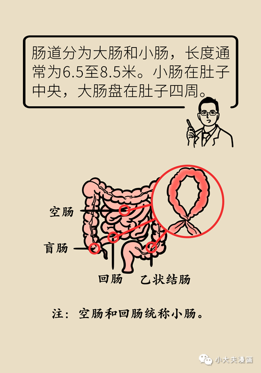 警惕肠扭转饭后运动须科学