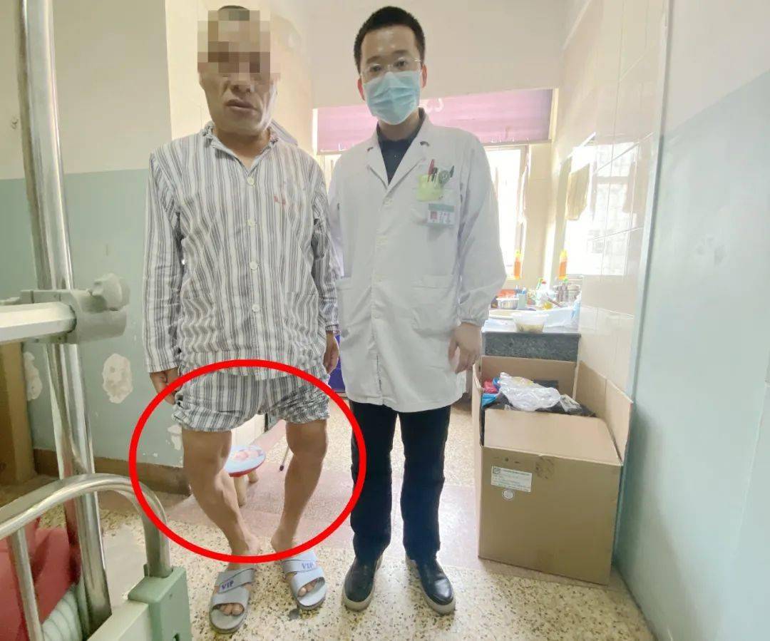 五官变厚四肢变大关节变粗发现这些症状一定要及时治疗