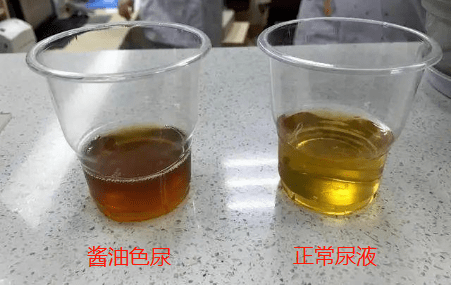 世界冠军老公进icu抢救,真相让人后怕