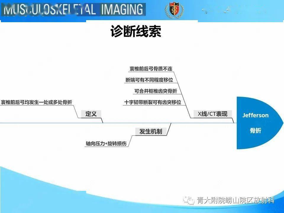 jefferson骨折_放射科