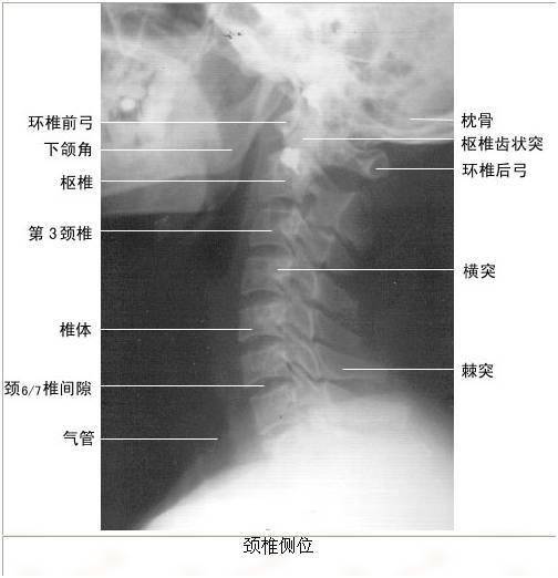 头颅正位x线解剖图图片