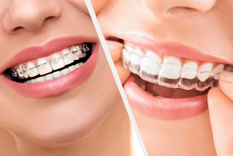 随着年龄的增长,面部,牙齿和颌骨肯定会发生变化,但是每个人都是独一