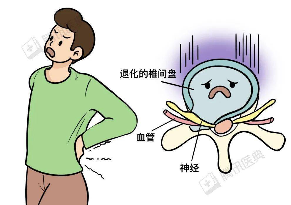 腰间盘突出卡通图图片