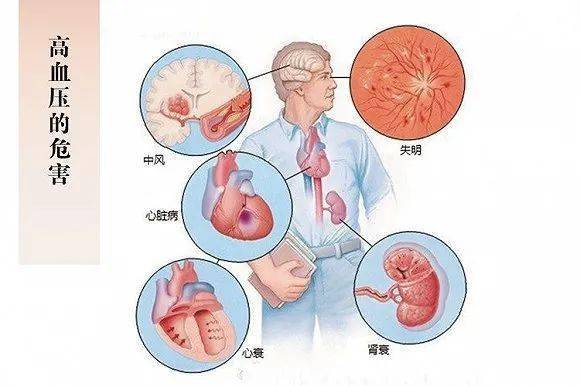 高血壓與心血管風險