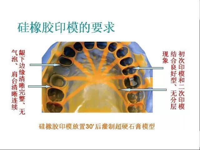 口腔印模 名词解释图片