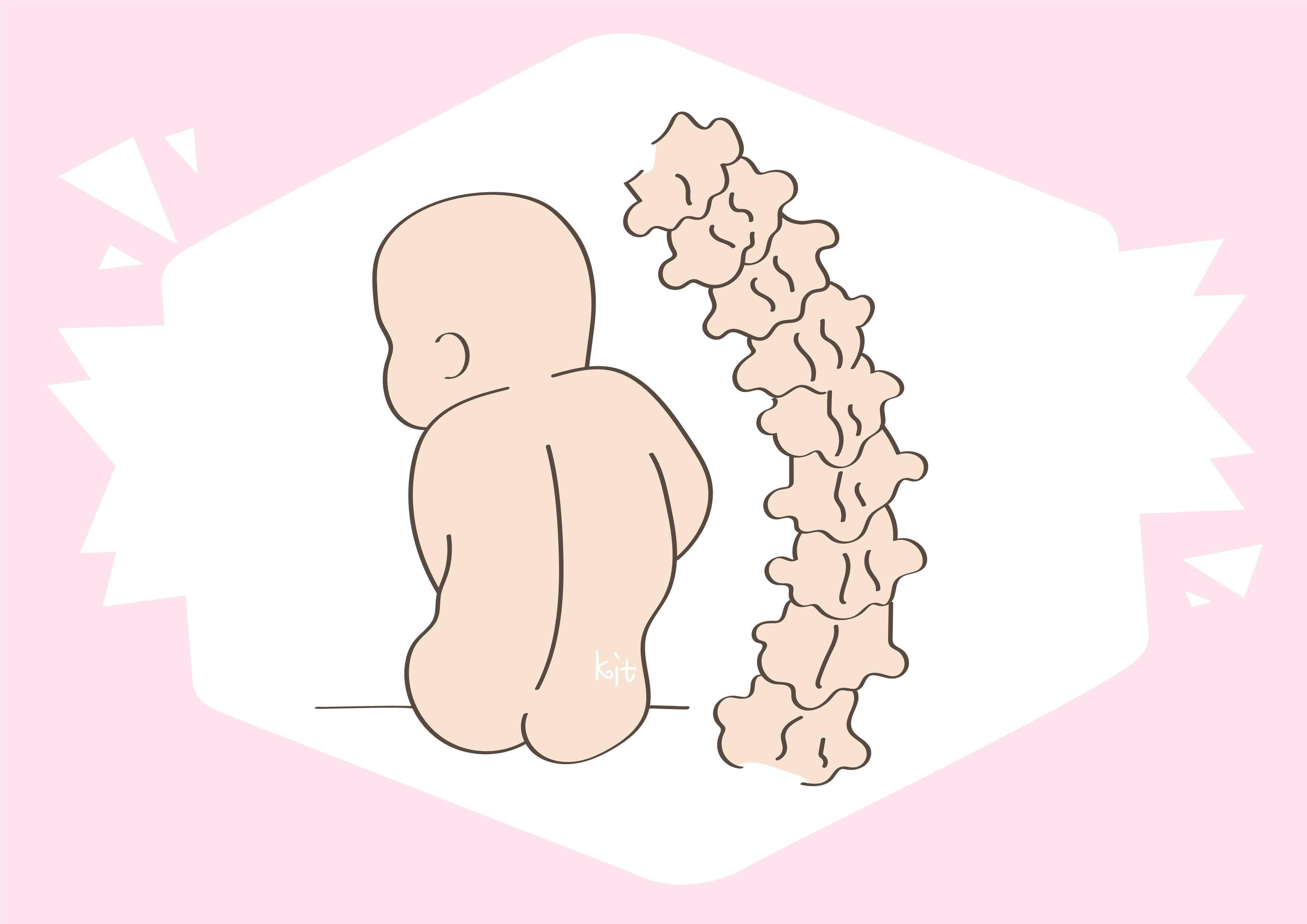 才六个月大的宝宝,脊柱已经出现变形,这些错误行为要注意