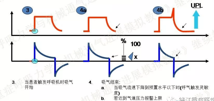 重症视角丨机械通气的基本模式