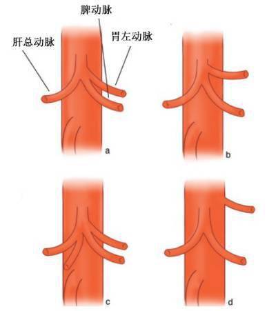 腹腔干的解剖,讲的太详细了_主动脉