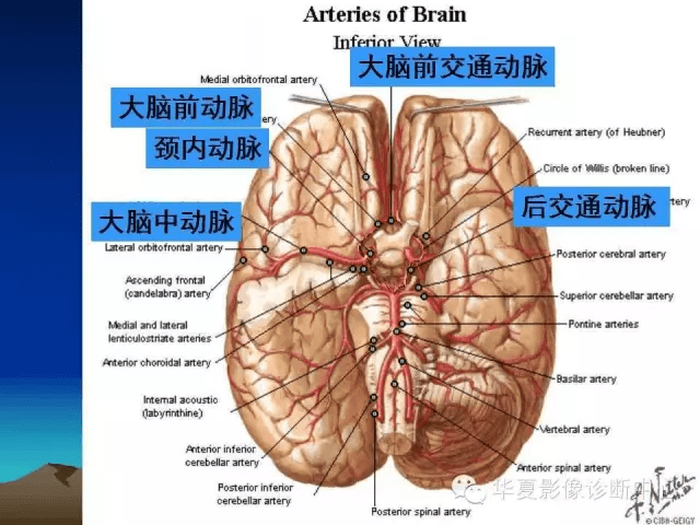 關於腦血管解剖你想要的都在這裡了