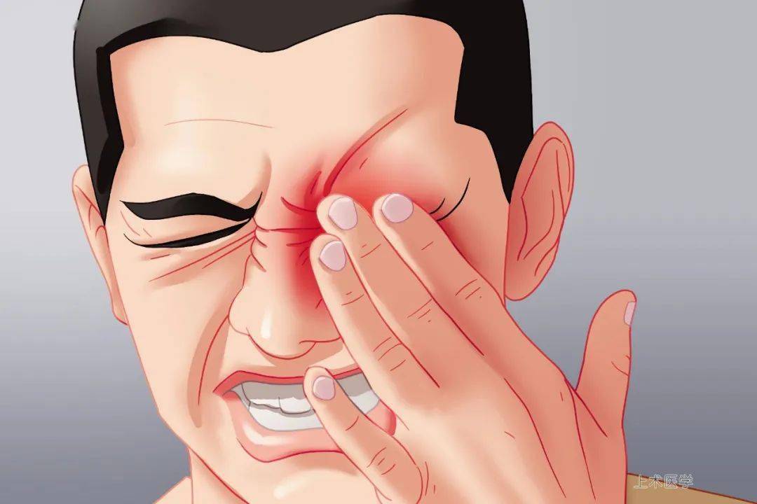 眼睛出现红血丝除了疲劳还可能是得了这些病