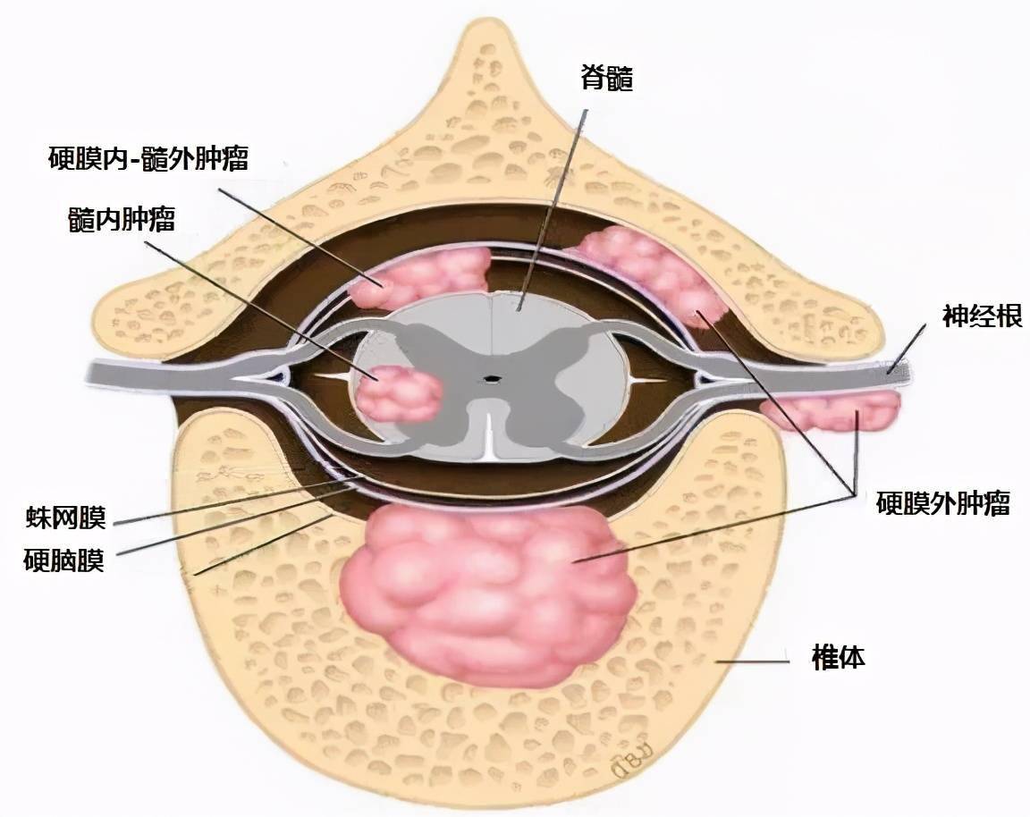 硬膜囊结构图片