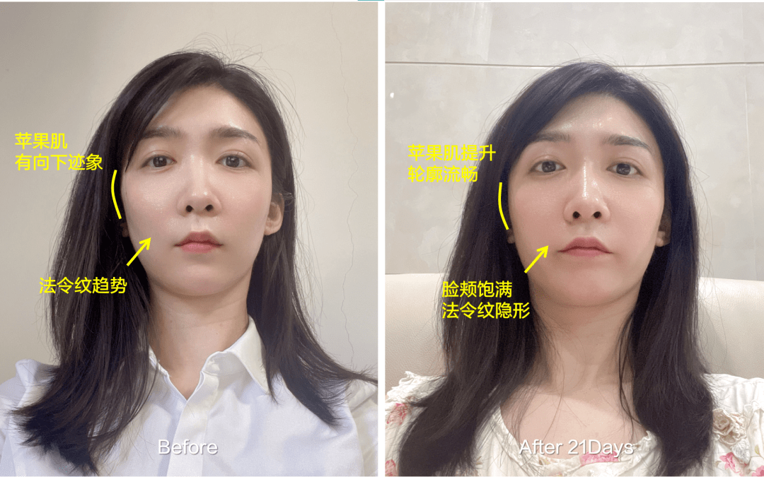 Before|秘籍 | 从滤镜美人到生图惊人，21天，拿捏了