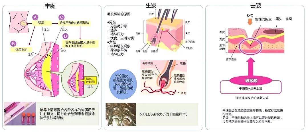 干细胞美容-不止是表现功夫_皮肤