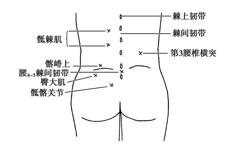 门诊最常见的下腰痛