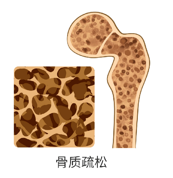 4fe75a55f53a4fc7b477dce5dafda1df.png