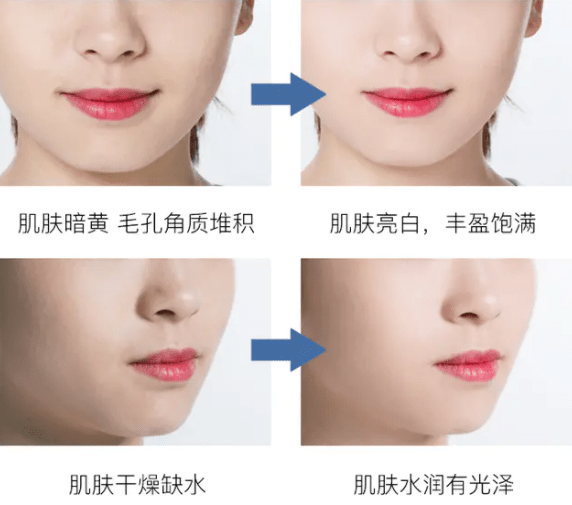 蒂佳|皮肤状态差？用它，20分钟搞定！