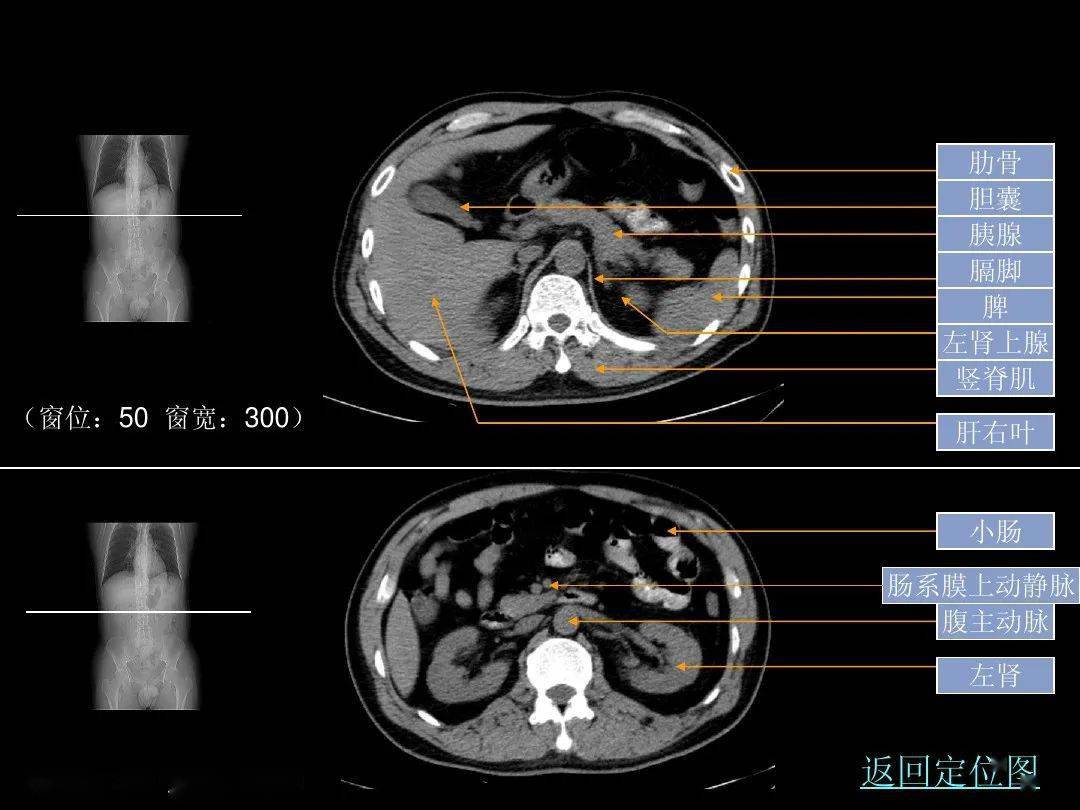 超细的腹部ct应用入门必备手册(原理 精美解剖图谱)