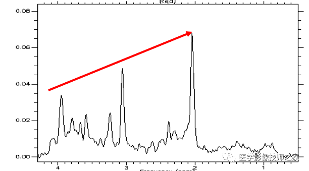脑组织能量代谢的提示物,峰度相对稳定,常作为波谱分析时的参照物