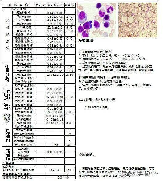 紫癜骨髓图片