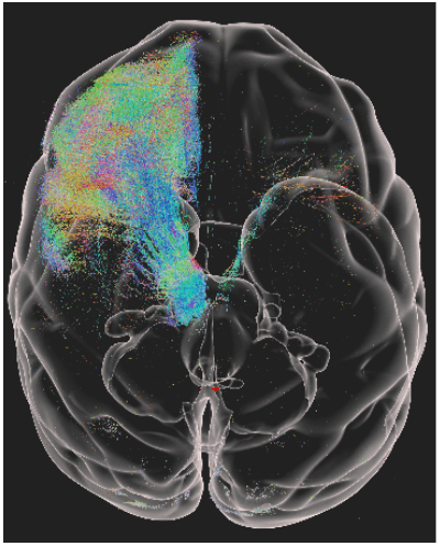 nature子刊中国科学家实现迄今最高精度猕猴大脑三维高清成像
