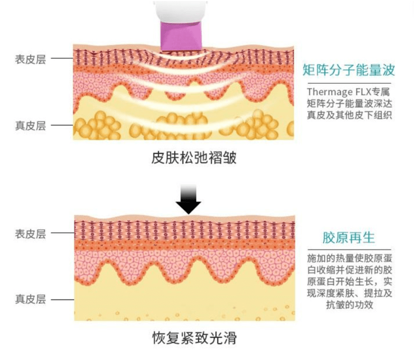 玛吉|孕期渣男出轨，导致终身不孕；终遇良人，老公却又死于意外，她太惨了