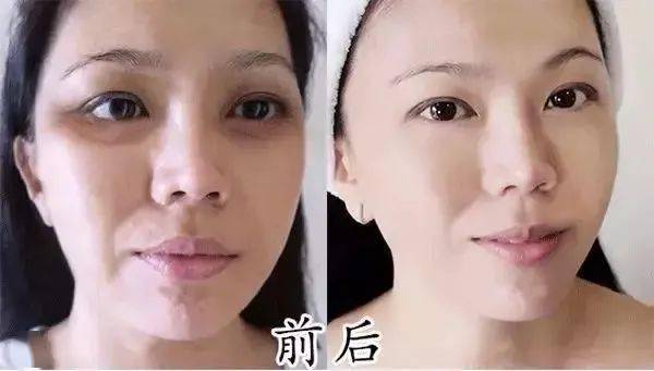 山本|日本少女的美白秘密：每天吃两粒，让你白到发光！
