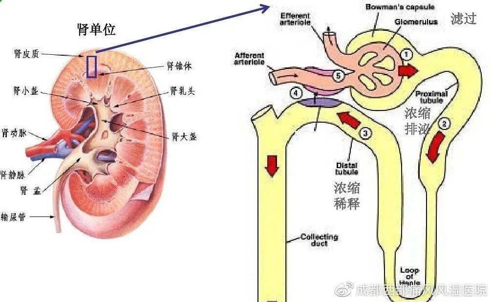 痛風合併腎臟疾病緩解關節疼痛藥物首選糖皮質激素