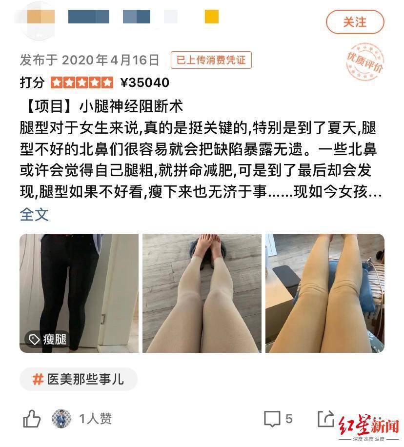 网友|这项“瘦小腿手术”被禁！仍有医美机构声称可以做，网友：赤裸裸的自残