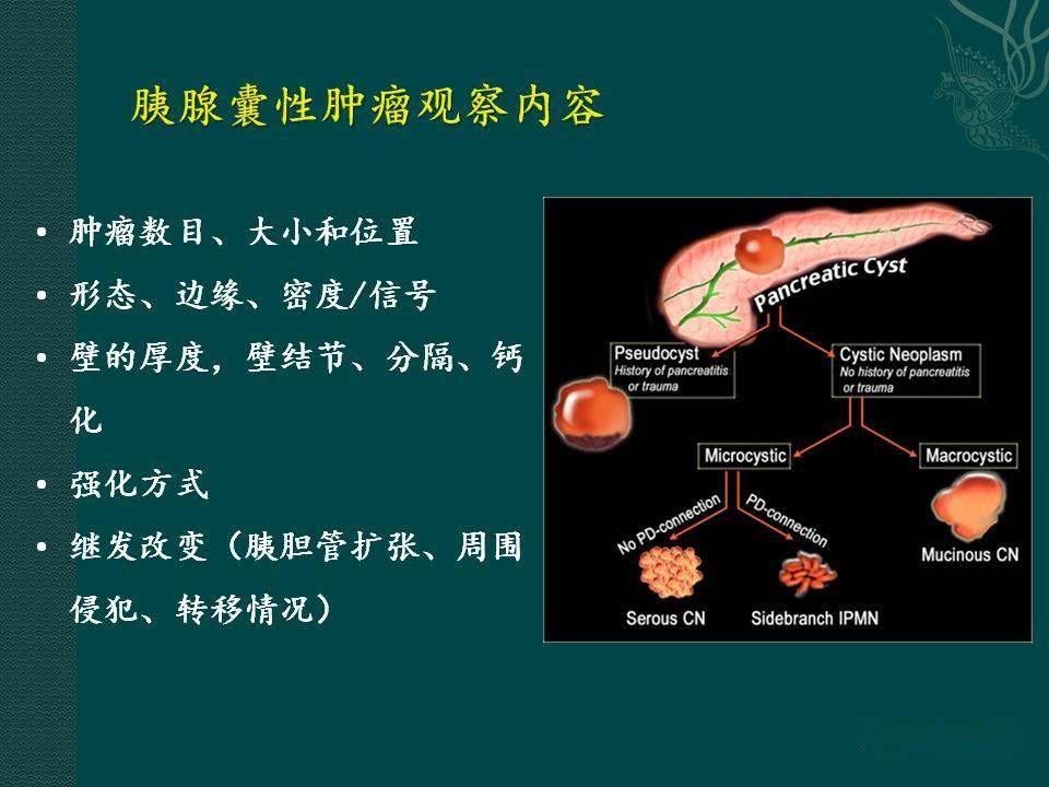 胰腺及脾臟病變影像診斷