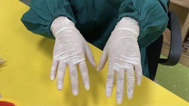 宁波这位女医生有一双粗糙脱皮的手!背后是200多天的坚守……_手套