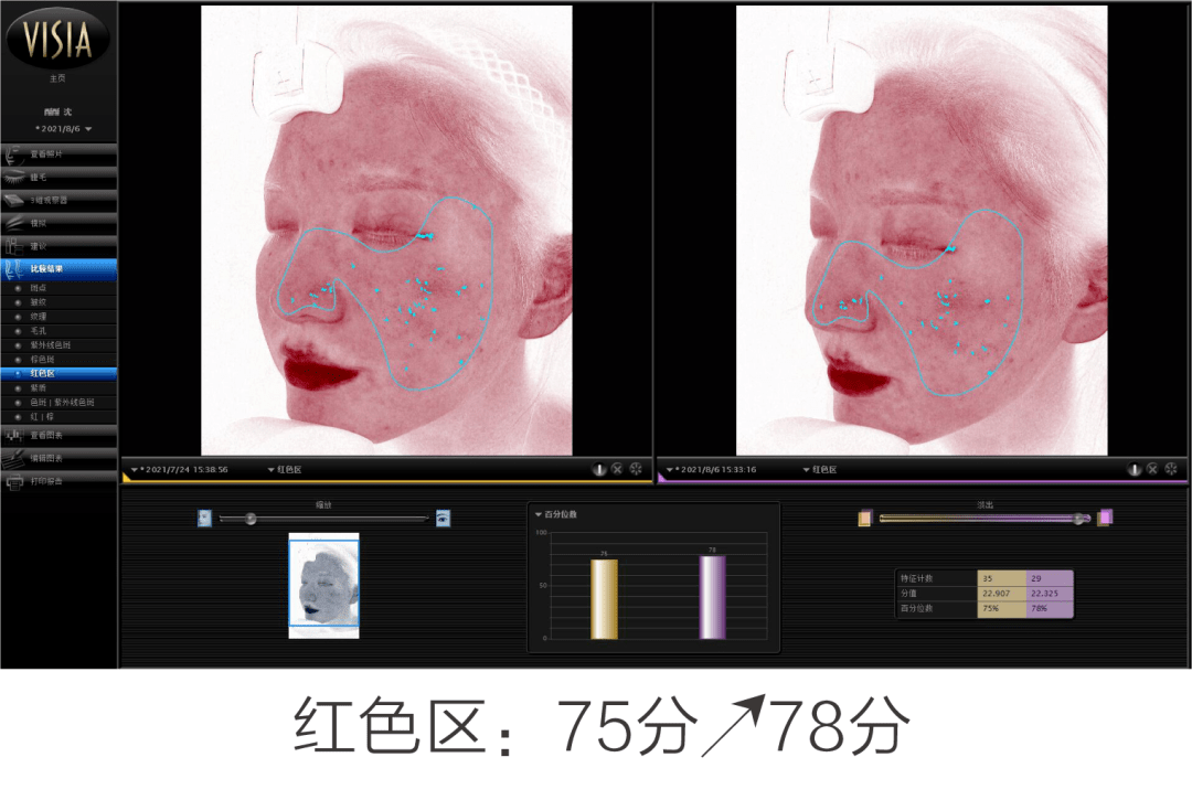 氛围|高阶评测 | 有效抗初老，氛围组out 实力组in！