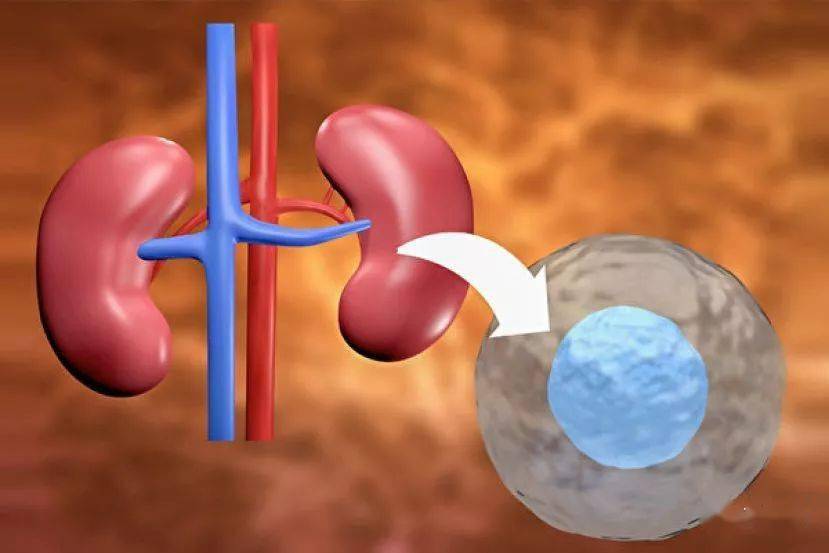 告別腎透析幹細胞療法又有新進展有望替代腎臟移植手術