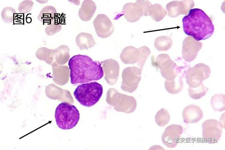 赛塞利细胞图片