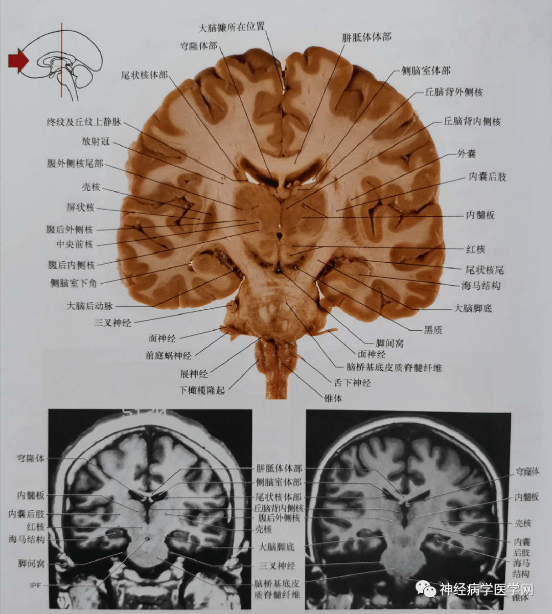 背侧丘脑断层解剖图图片