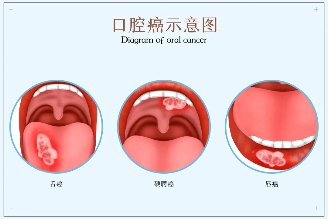 84f0fb4d269f4431848acee9a4a24b25.png