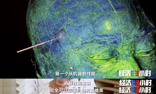 技术|重大利好！不开颅治疗脑肿瘤，费用预计为国外的5%！