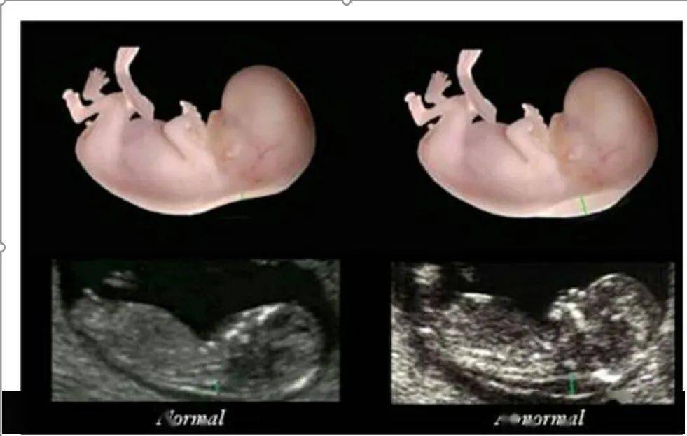 氏是什么时候出现的 c0047fcb374c4ae199a173bbaa3013b0.jpeg