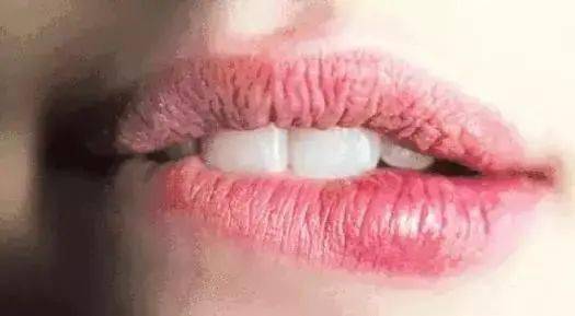 双唇|收藏~护唇6大妙招，还你水润光泽的嘴唇！