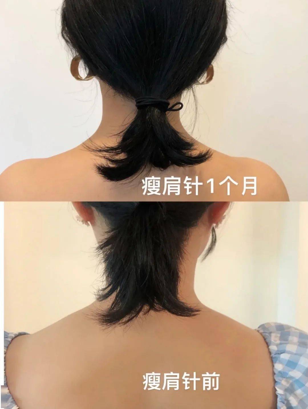 芽芽|女明星最爱做的注射微整，都被我扒出来了！