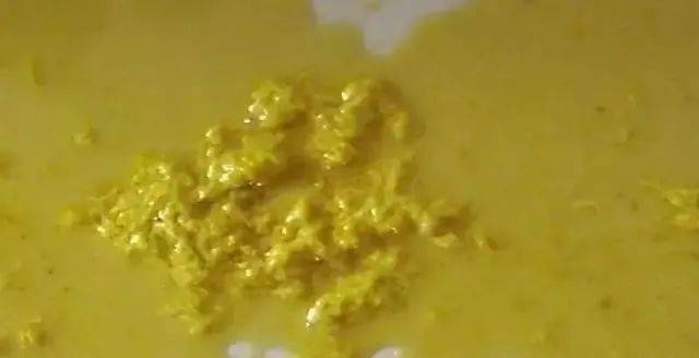 各种宝宝大便图片分析!娃的便便是否正常,对照一下就知道!_肠道