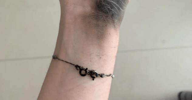 插座|女子这样拔插头，引发爆炸！手掌黑了一大片、还有焦味