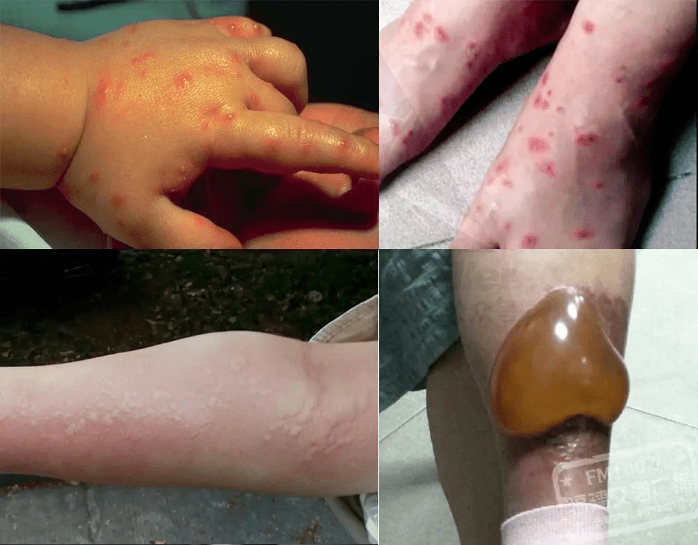 防范"无敌外来物种"入侵!