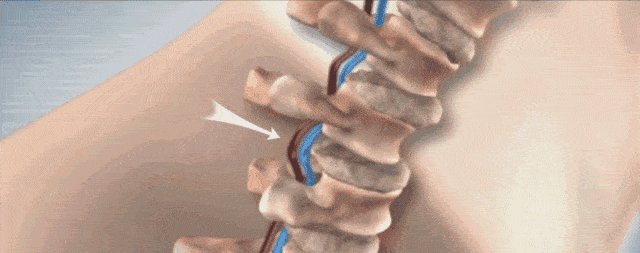 博士|年纪轻轻腰就垮了！现代人的痛，怎么拯救？