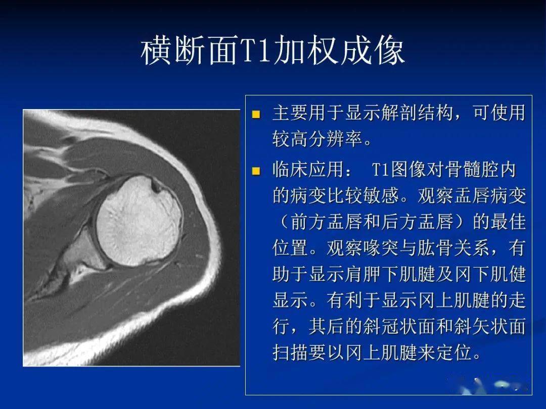 肩袖解剖及损伤的临床及mri诊断