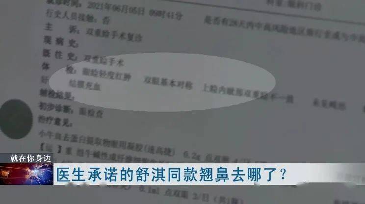 症状|说好的整成舒淇同款鼻,结果连微笑都成问题!更麻烦的是……