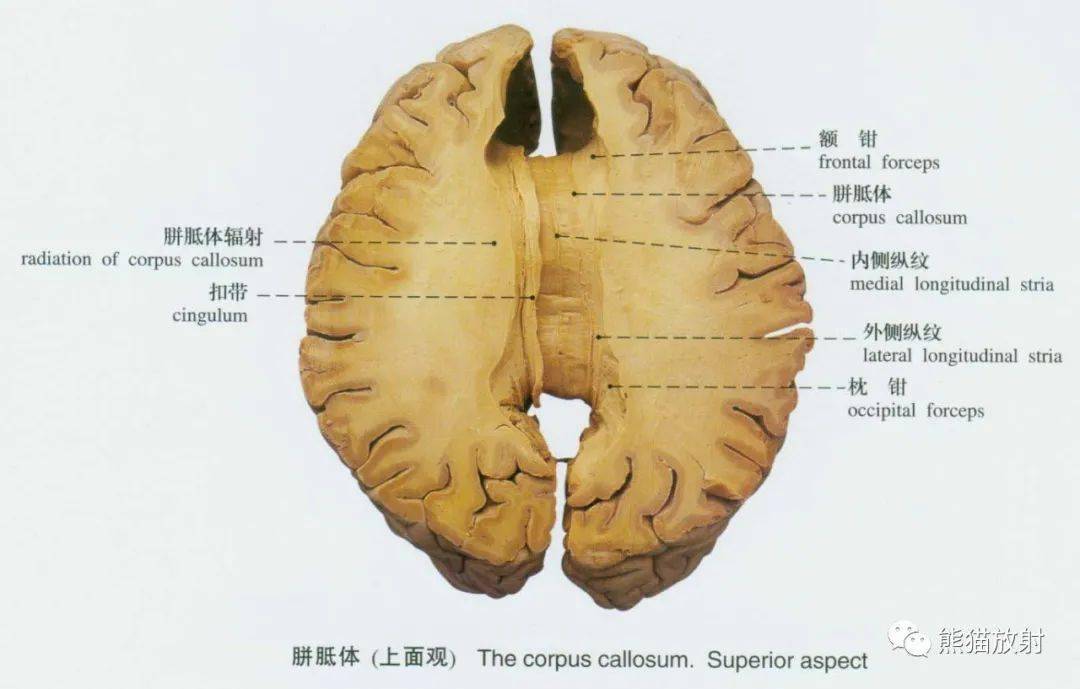 系統解剖標本圖譜丨脊髓,腦~_影像