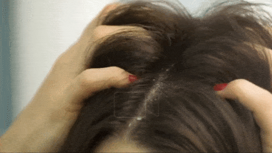 洗头|5天不洗头也能清爽到家?87岁康王创始人再出山,专治头痒头油脱发!