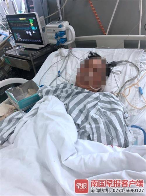 医学科|清洗海鱼时感染细菌，广西一老伯为保命遭截肢