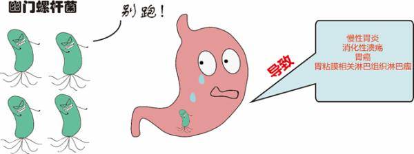 幽门|如何知道自己感染了幽门螺杆菌？