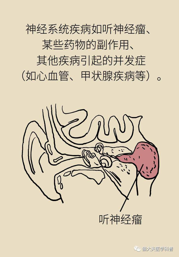 张明山|耳鸣是人老了听力不行了？错，可能藏着个大病